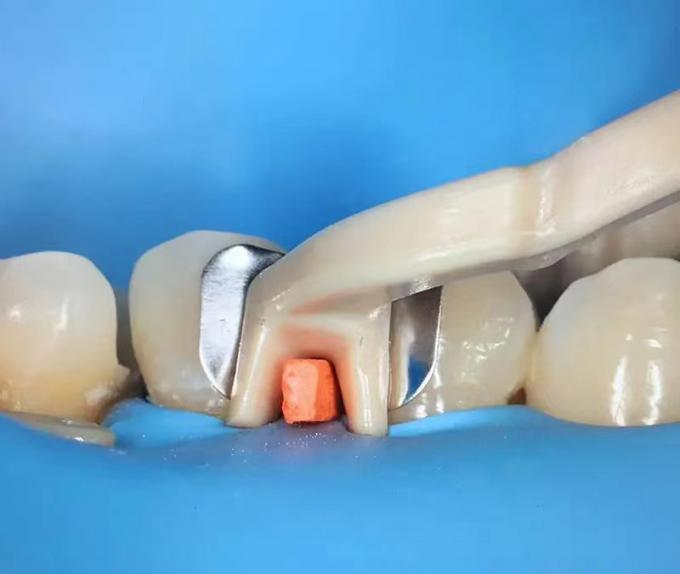 Dental Sectional Matrix System F2 Autoclavable includes Sectional Matrix Bands M2 + Resin Clamping Ring R3 4
