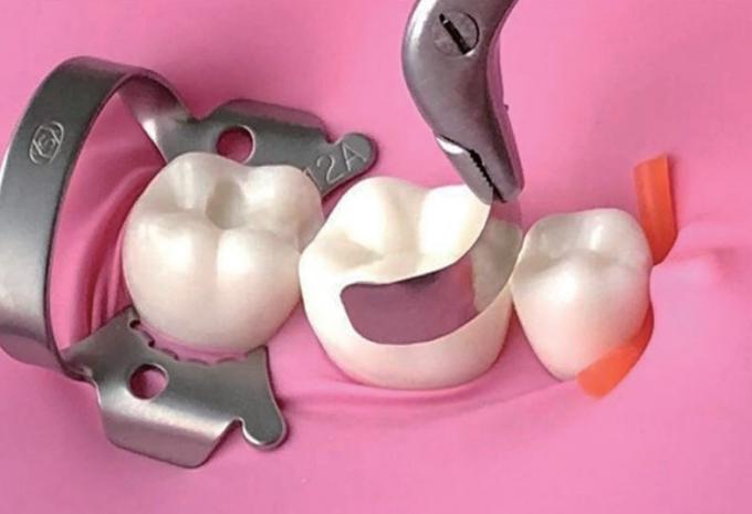 Sectional Matrix Band Dental Use In Teeth M2 1