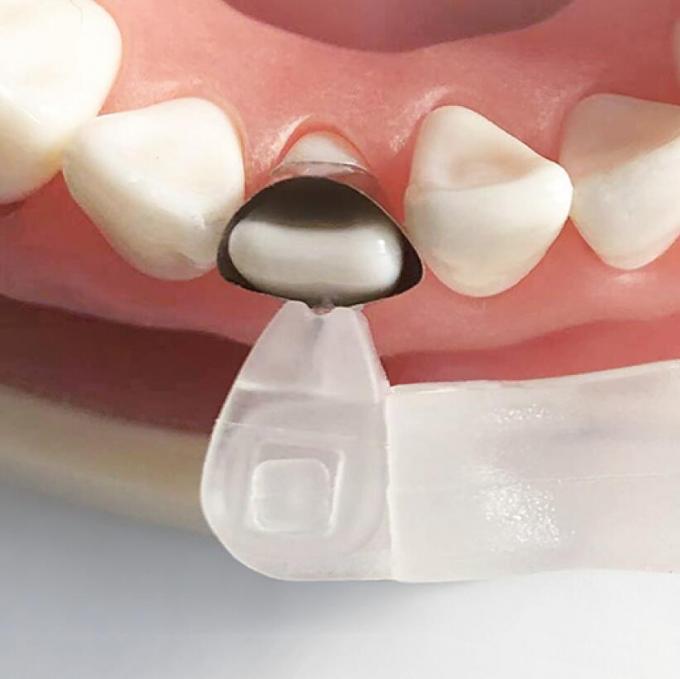 Universal Matrix Band Retainer M5 2.0 1