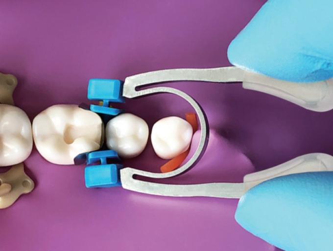 Composite Dental Sectional Matrix System Clamp Ring R4 2.0 0