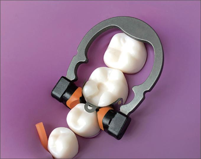 Triodent V3 Dental Sectional Matrix System Set Clamp Ring R5 1.0 3