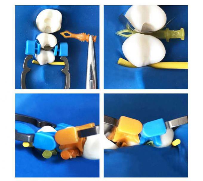 ISO Dental Sectional Matrix System Plastic Matrix Band Diamond Wedges W4 2.0 1