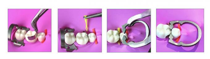 ISO Dental Sectional Matrix System Plastic Matrix Band Diamond Wedges W4 2.0 2