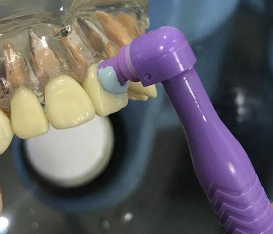 Plastic Disposable Prophy Angle With Brush Snap On Soft Buckle Ribbed Cup Head Green 4