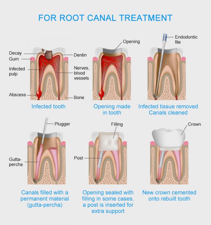 Dental Gutta Percha Points Diadent Gp Points  Absorbent Paper Points Dental Consumable Suppliers 1