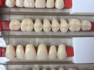 High Wear Resistance Dental Acrylic Resin Teeth For Biocompatibility