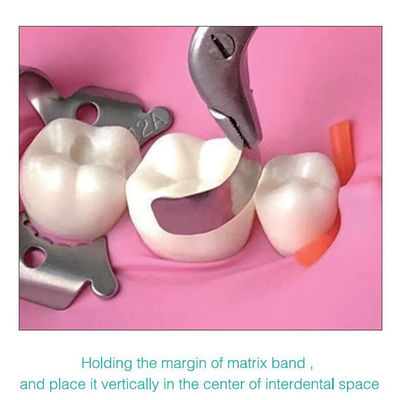Sectional Matrix Band Dental Use In Teeth M2