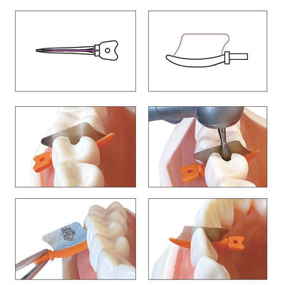 Dental Sectional Matrix System Wedge Guards M3 3.0